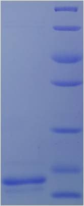 Bovine TGFB1 / TGF Beta 1 Protein (Recombinant His)