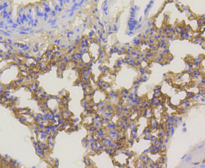 Monoclonal Rabbit anti-Human AKT1 Antibody (phospho-Ser473, IHC, IF, WB)