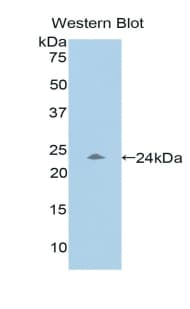 PZP Antibody (aa1212-1391)