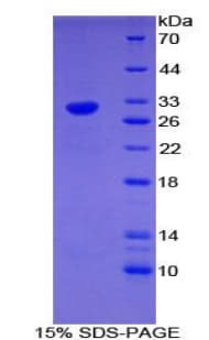 Mouse EGR4 / EGR-4 Protein (Recombinant His-T7)