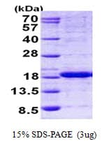 Human HINT2 Protein (Recombinant His)