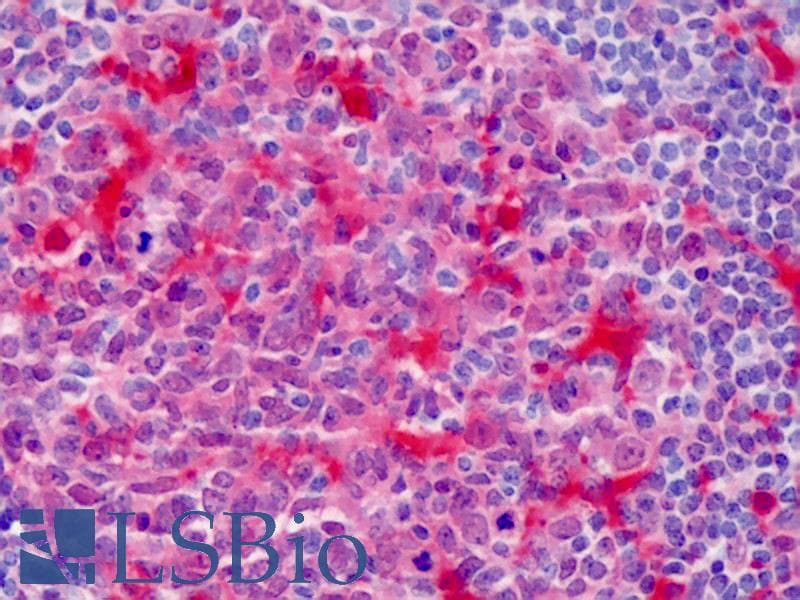 IHC-plus™ PLEK / Pleckstrin Antibody (clone 6E3)