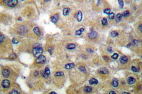 SCGB2A1 / Mammaglobin B Antibody (Lys23)