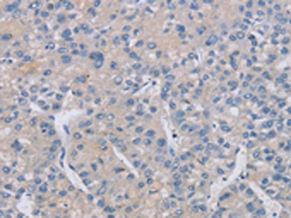 CREBZF / Zhangfei Antibody