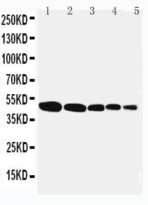 FLOT1 / Flotillin 1 Antibody (aa219-234)