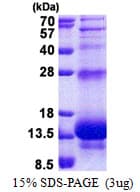 Human PI3 / Elafin Protein (Recombinant His)
