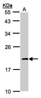 NDUFS4 Antibody (aa1-175)