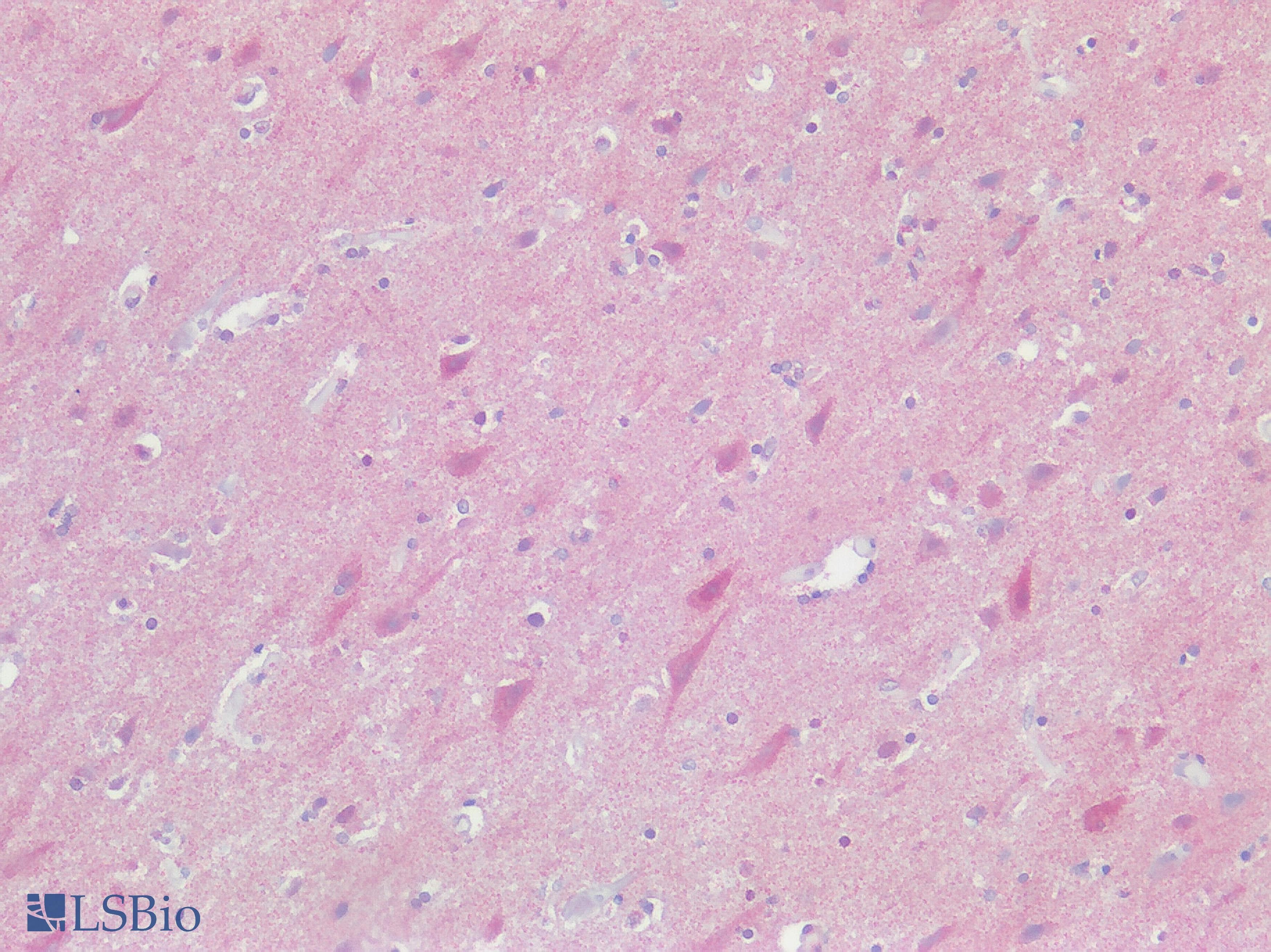 IHC-plus™ ADORA3 / Adenosine A3 Receptor Antibody (Cytoplasmic Domain)