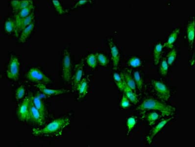 Polyclonal Rabbit anti-Human FARP2 / FRG Antibody