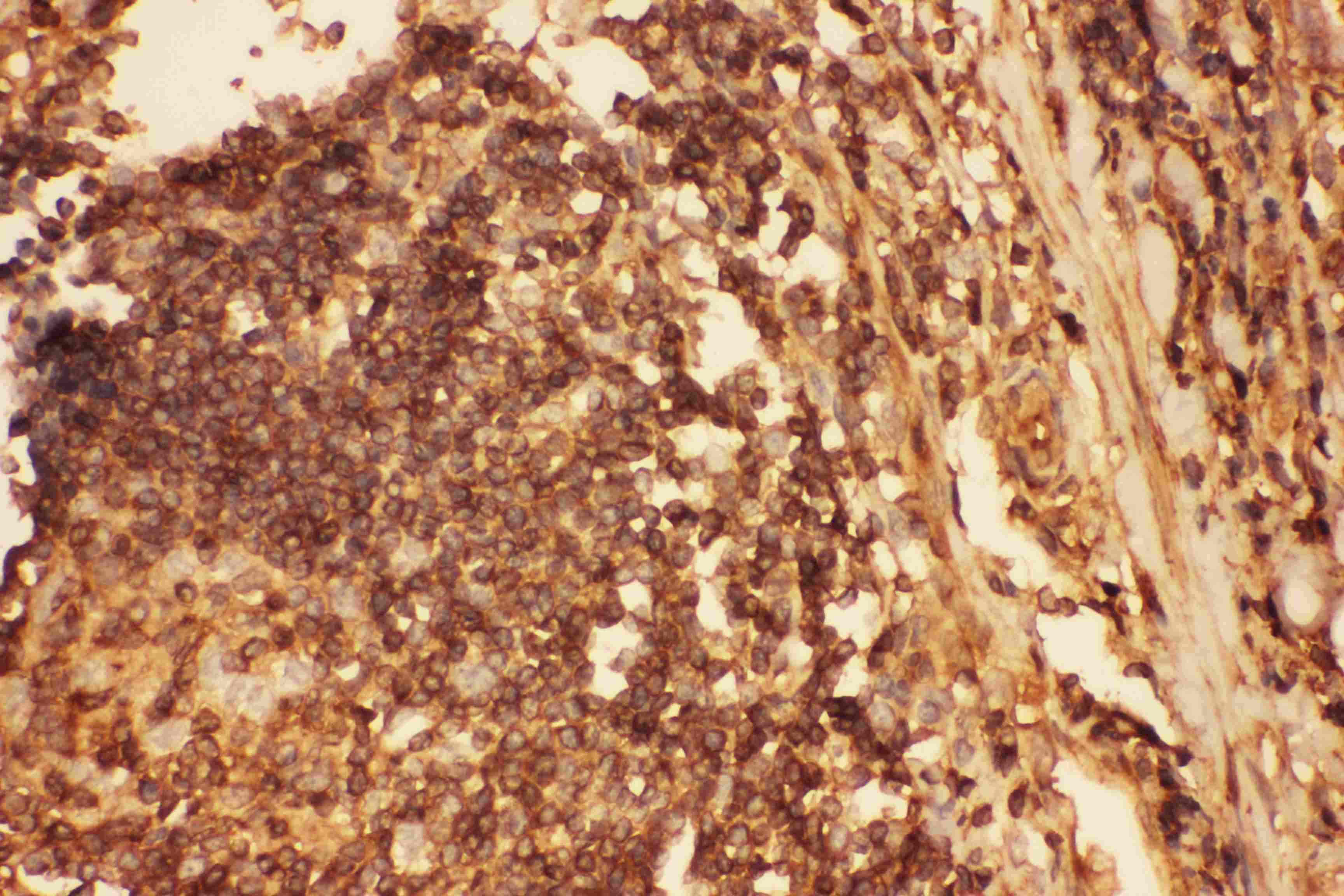 Polyclonal Rabbit anti-Human CFL1 / Cofilin Antibody (aa2-166, IHC, WB)