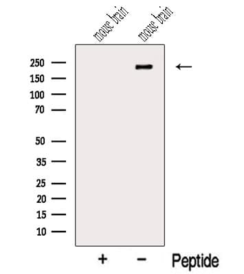 Polyclonal Rabbit anti-Human NISCH Antibody (WB)