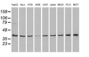MAPK1 / ERK2 Antibody (clone OTI4D10)