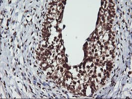 LMO2 Antibody (clone OTI1G10)