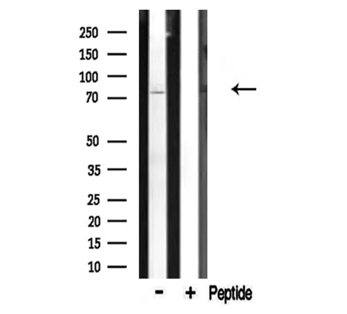 Polyclonal Rabbit anti-Human CDH9 / Cadherin 9 Antibody (IHC, IF, WB)