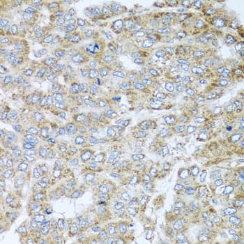 Polyclonal Rabbit anti-Human NDUFA2 Antibody (IHC, WB)