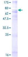 Human NMUR1 Protein (Recombinant GST)