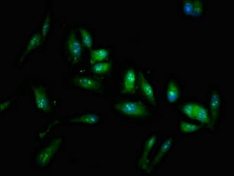 LIN28A / LIN28 Antibody