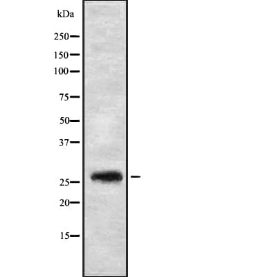 FGFBP3 Antibody