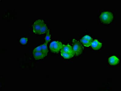 IHC-plus™ PTPN6 / SHP1 Antibody