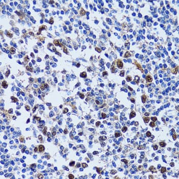UHRF1 Antibody