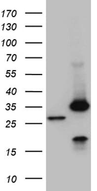 PSMA7 Antibody (clone OTI8B11)