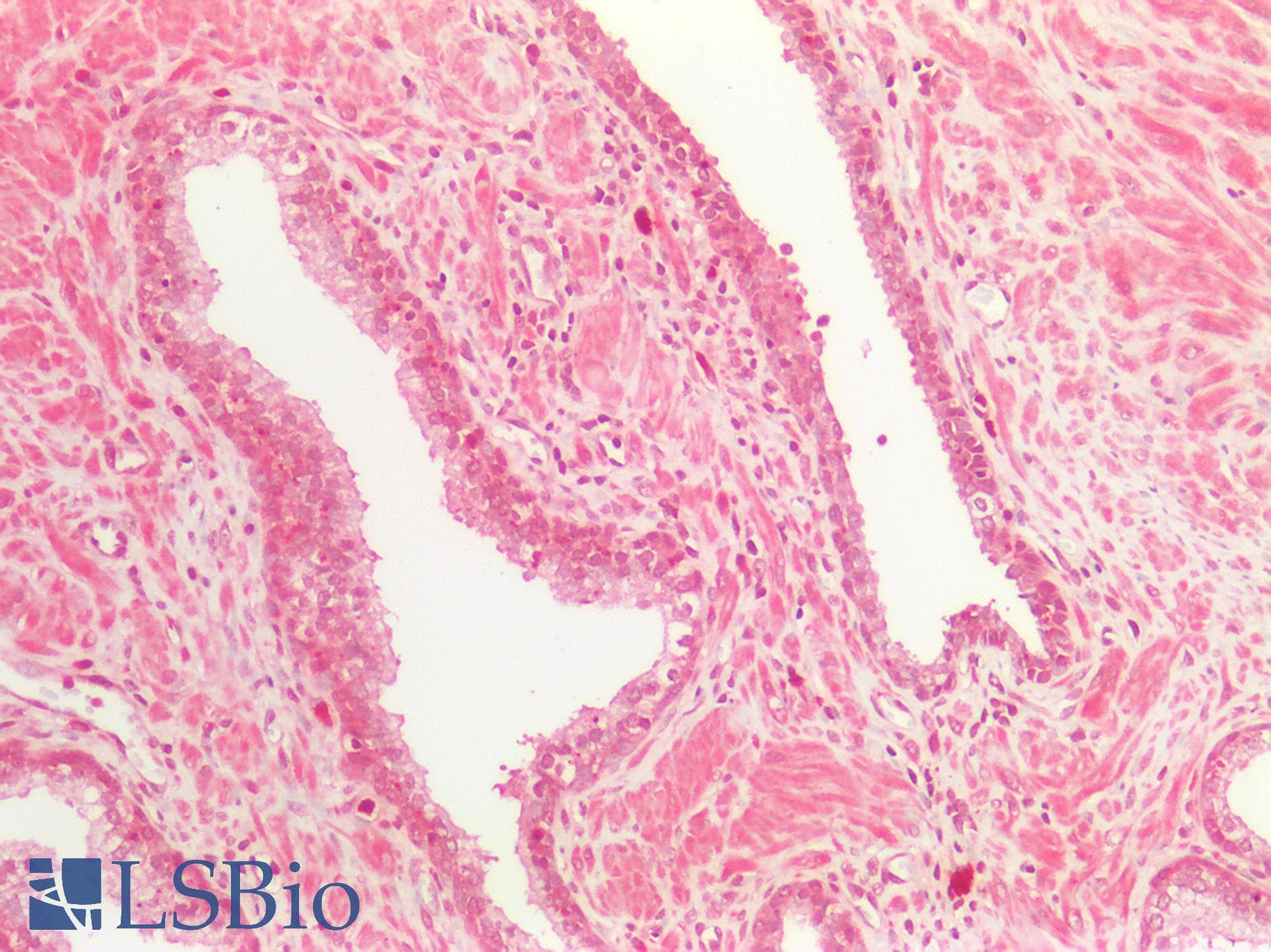 PathPlus™ EIF4EBP1 / 4EBP1 Antibody (aa30-79)