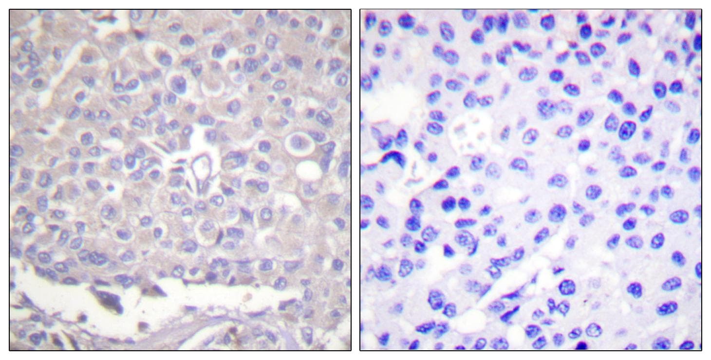 Polyclonal Rabbit anti-Human ITGB1 / Integrin Beta 1 / CD29 Antibody (phospho-Thr788, IHC, WB)