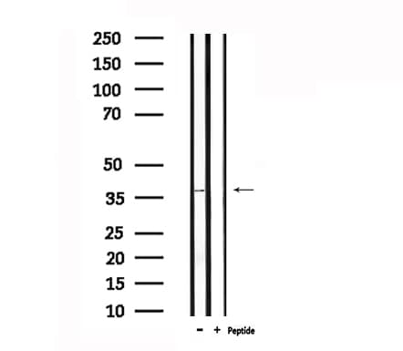 ADORA1 / Adenosine A1 Receptor Antibody