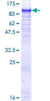Human ZBTB39 Protein (Recombinant GST)