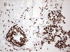 Monoclonal Mouse anti-Human HNRPM / HNRNPM Antibody (clone OTI3F3, aa1-261, IHC, WB)