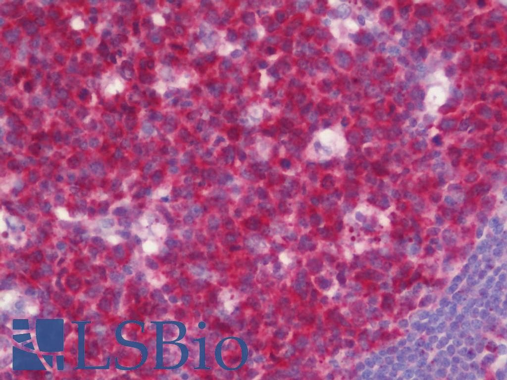IHC-plus™ BCL2L10 / Diva Antibody (aa60-153)