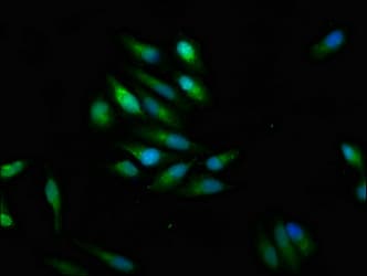 SCN9A / Nav1.7 Antibody
