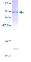 Human ARRDC3 Protein (Recombinant GST)