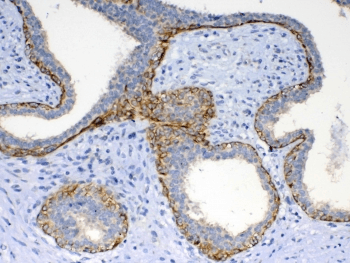 FZD4 / Frizzled 4 Antibody