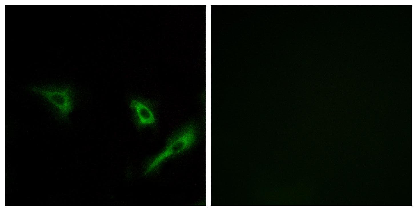 Polyclonal Rabbit anti-Human ATG4A Antibody (IHC, IF)