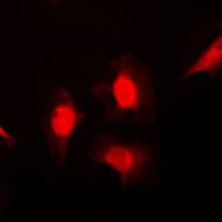 HSPA8 / HSC70 Antibody (Internal)