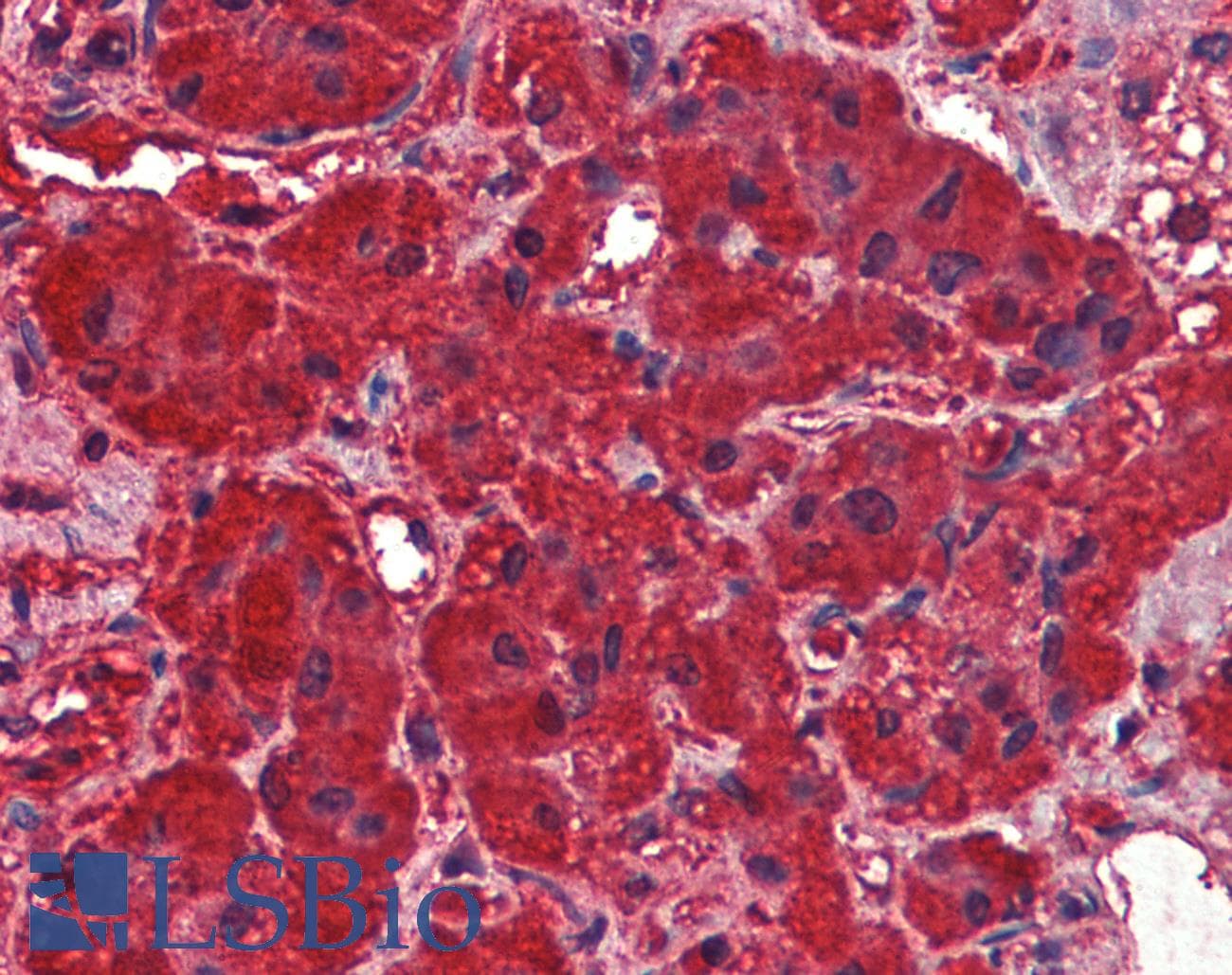 IHC-plus™ Polyclonal Goat anti-Human DNM3 / Dynamin 3 Antibody (aa634-645, IHC)