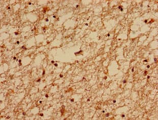 MED24 / TRAP100 Antibody