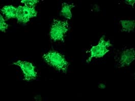 KATNB1 Antibody (clone OTI3B6, Carrier-free)