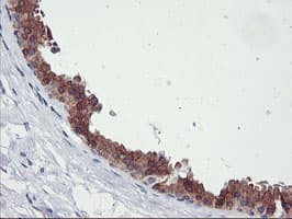 TIMP2 Antibody (clone OTI1D7, Carrier-free)