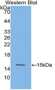ASGR1 / ASGPR Antibody (aa80-281, PE)