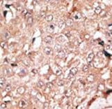Polyclonal Rabbit anti-Human KDM1A / LSD1 Antibody (aa819-852, IHC, IF, WB)