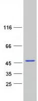 Human CNN3 Protein (Recombinant Myc-DDK (Flag))
