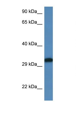 DLX6 Antibody (C-Terminus)