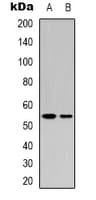 TP53 / p53 Antibody (C-Terminus)