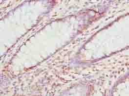 Polyclonal Rabbit anti-Human MAT2A Antibody (IHC)