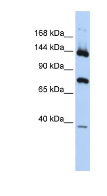 Polyclonal Rabbit anti-Human JMJD7 Antibody (aa179-228, WB)