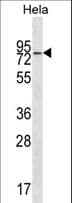 Polyclonal Rabbit anti-Human WASF2 / SCAR2 Antibody (aa162-190, WB)