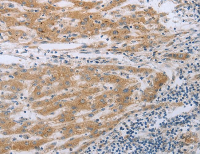 TNK2 / ACK1 Antibody