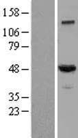 Human Dynactin 2 / Dynamitin Protein (Over-Expression Lysate Myc-DDK (Flag))
